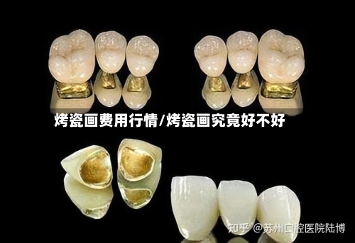 烤瓷画费用行情/烤瓷画究竟好不好-第3张图片