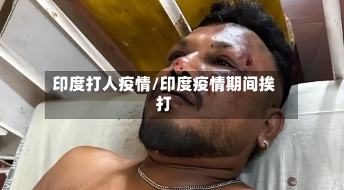 印度打人疫情/印度疫情期间挨打-第2张图片